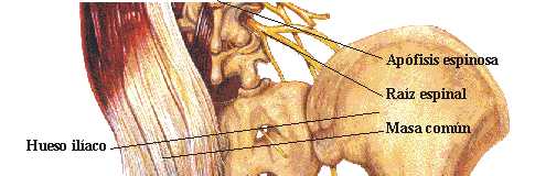 LUMBOCIATALGIA