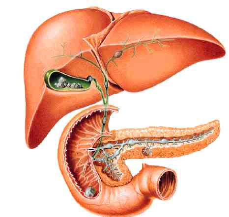 obstruccion intestinal